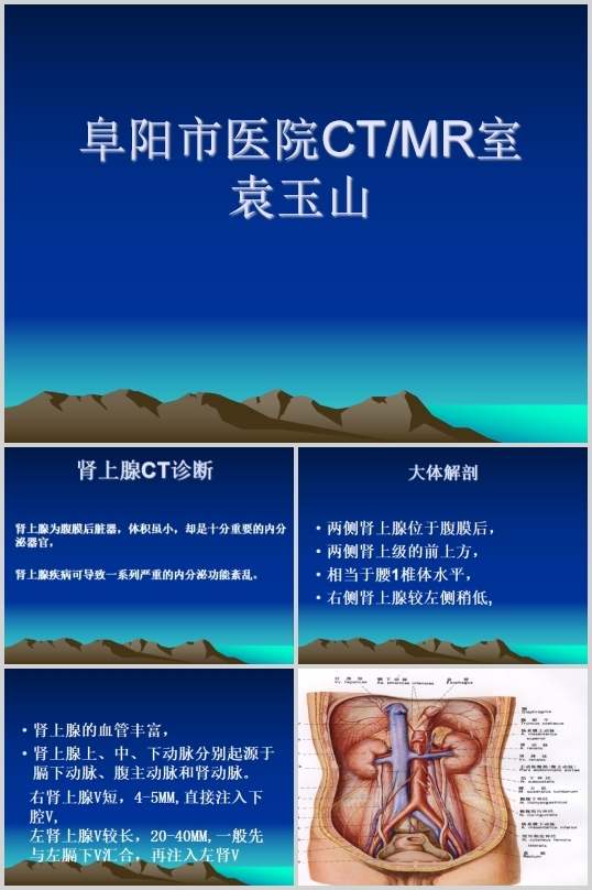 �I����CT�\���B(PPT 125�)